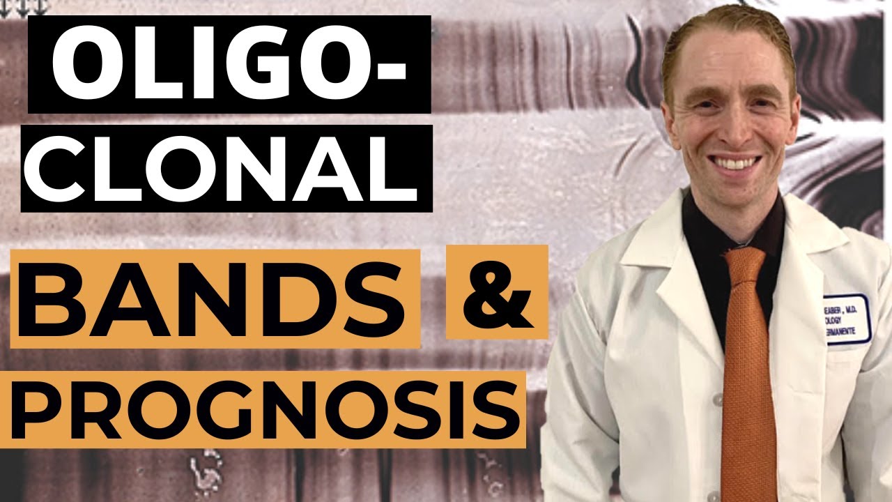 Do Oligoclonal Bands Affect Prognosis of Multiple Sclerosis