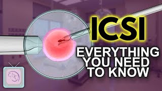 IVF ICSI Procedure - Important things you need to know