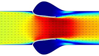 2D Fluid-Structure Interaction (FSI) Simulation of Aortic Valve / Using COMSOL Multiphysics