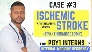 Acute Ischemic Stroke(Within Therapeutic Window for TPA) - Internal Medicine Residency Series