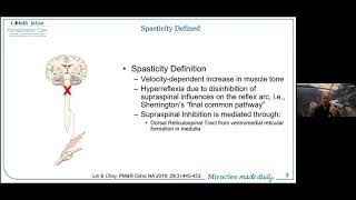 Spasticity after Spinal Cord Injury