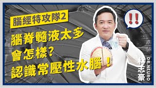 腦袋的水排不出去？逐漸走不動，記憶差 恐是「常壓性水腦」【林志豪醫師】What if the brain fill with too much fluid inside?