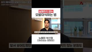 모발이식 실패하지 않는 방법(믿을 수 있는 병원을 찾으세요)ㅣ뉴헤어