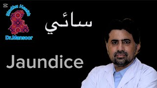 Jaundice | hepatitis | Sindhu health | Dr.Mansoor Ali | in Sindhi language | awareness