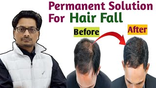 STOP Losing 50-100 Hairs Daily With These 3 Hair Regrowth Treatments [हिंदी में] #hairfall #alopecia