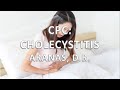 CLINICOPATHOLOGIC CORRELATION: CHOLECYSTITIS