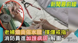 老婦燒燙傷水腫「撐爆戒指」 消防員進加護病房「解圍」 ｜TVBS新聞@TVBSNEWS02