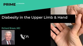 Diabesity in the Upper Limb \u0026 Hand- Richard Braun, MD