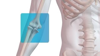 Distal Biceps Repair with Arthrex® Tension Slide