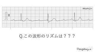 12/1心電図道場解説