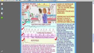 SESSIONS FOR NURSES 33- ICU-CCU CARE - The Basics