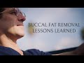 6 Months After My Buccal Fat Removal: Honest Thoughts, Feelings, and Results | 2024