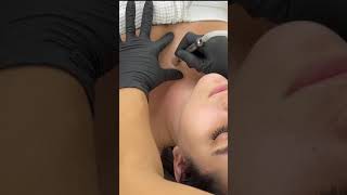 Microdermabrasion with OOMNEX MaxiSpa