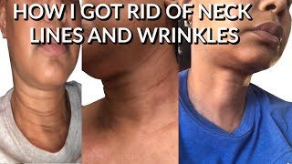 HOW  TO GET RID OF NECK WRINKLES AND DARK LINES