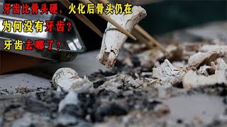 牙齿比骨头硬，火化后骨头仍在，为何没有牙齿？牙齿去哪了？