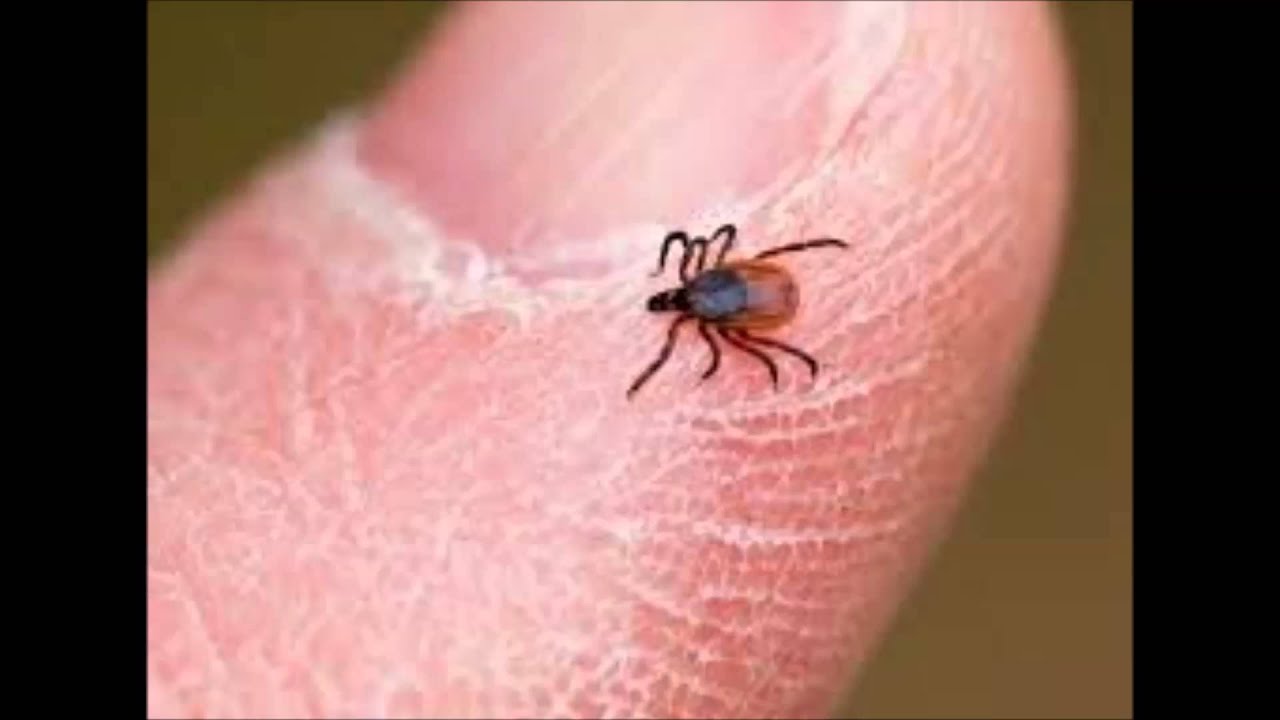 Ticks And Lyme Disease - YouTube