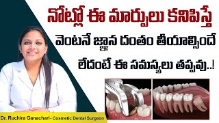 జ్ఞానదంతం నొప్పికి శాశ్వత పరిష్కారం || Wisdom Tooth Extraction in Telugu || Eledent Dental Hospitals