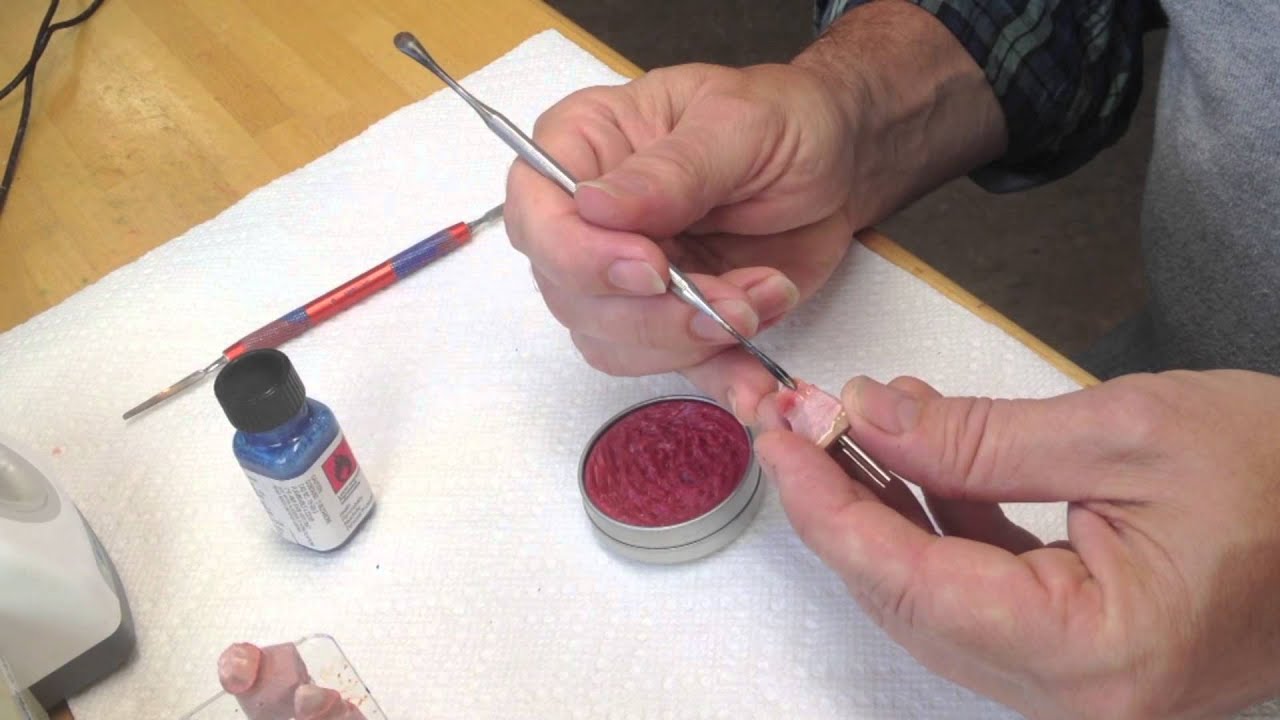 Die Preparation: Flemming's Dental Ceramics Teaching Video - YouTube