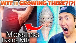 Plastic Surgeon Reacts to MONSTERS INSIDE ME! What's In His SACK?