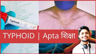 Typhoid | Apta शिक्षा #BAMS #AYURVEDA