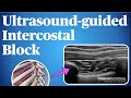 Ultrasound-Guided Intercostal Nerve Block