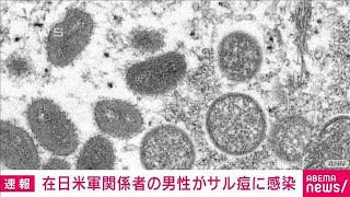 横田飛行場所属の米軍関係者の男性サル痘感染(2022年8月5日)