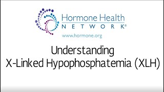 X Linked Hypophosphatemia XLH