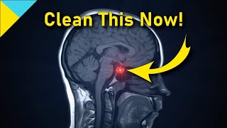 10100 Hertz: Heal Pituitary Gland ❯❯❯ WAIT TILL 6 Mins! • Quantum Miracle Formula Frequency