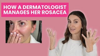 How a Dermatologist Manages Her Rosacea | Dr. Aleksandra Brown's Skincare \u0026 Treatment Plan