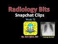 radiology bits snapchat week 72