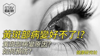 黃斑部病變好不了!?黃斑部病變原因?如何預防?【健康研究社】