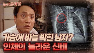 [놀라운 세상] 가슴에 바늘 박힌 남자? 인체의 놀라운 신비｜#놀라운세상 MBC030805방송