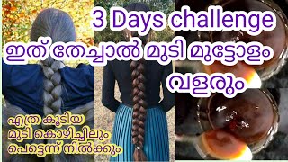 ❤️ഇത് തേച്ചാൽ മുടി മുട്ടോളം വളരും#Fast hair growth, Dandruff,Hair fall,ഉപയോഗിക്കു റിസൾട്ട് അറിയു