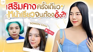 เสริมคางหน้าเปลี่ยนไหม? | รีวิวลูกสาวหมอ Sowon clinic ep.295