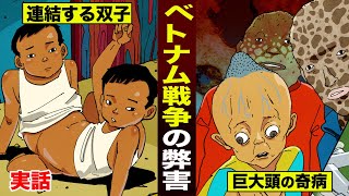 【実話】連結した双子...頭でっかち人間。ベトナム戦争の枯葉剤が生んだ。