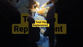 Total Hip Replacement Surgery | Live Hip Surgery | #hipreplacementsurgery #hipre