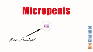 Stop Micropenis Concerns! | UroChannel
