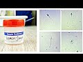 Semen Analysis Test Lab | Hypo Osmotic Swelling (HOS) Test Protocol