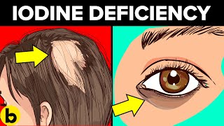 7 Signs You Have An Iodine Deficiency