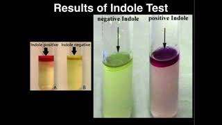 Microbiology: Indole Test (Tryptophanase)