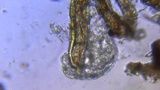Tardigrade microscopy