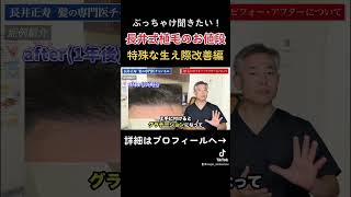 【生え際を大きく改善！！】長井式植毛のお値段も紹介#shorts