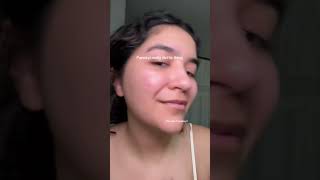 Resharing one of my viral videos from TikTok sharing my acne results using PanOxyl @panoxyl