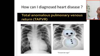 Case 229  how can I detect if this patient having cardiac, pulmonary or upper airway problems ? OXYG