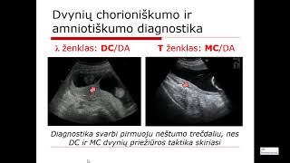 Prenatalinė ultragarsinė patikra. Doc. E. Machtejevienė