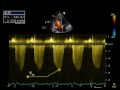 14. estimating right ventricular pulmonary artery systolic pressure from tr jet