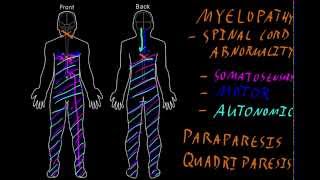 Myelopathy