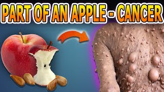 Never Eat This Part of an Apple! If You Eat These Altered Sections, Cancer Cells Could Explode!