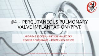 Interventional cardiology - Percutaneous pulmonary valve implantation