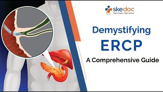 Demystifying ERCP: A Comprehensive Guide